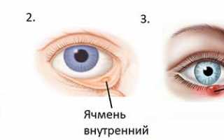 Что делать если у ребенка покраснело и опухло верхнее веко